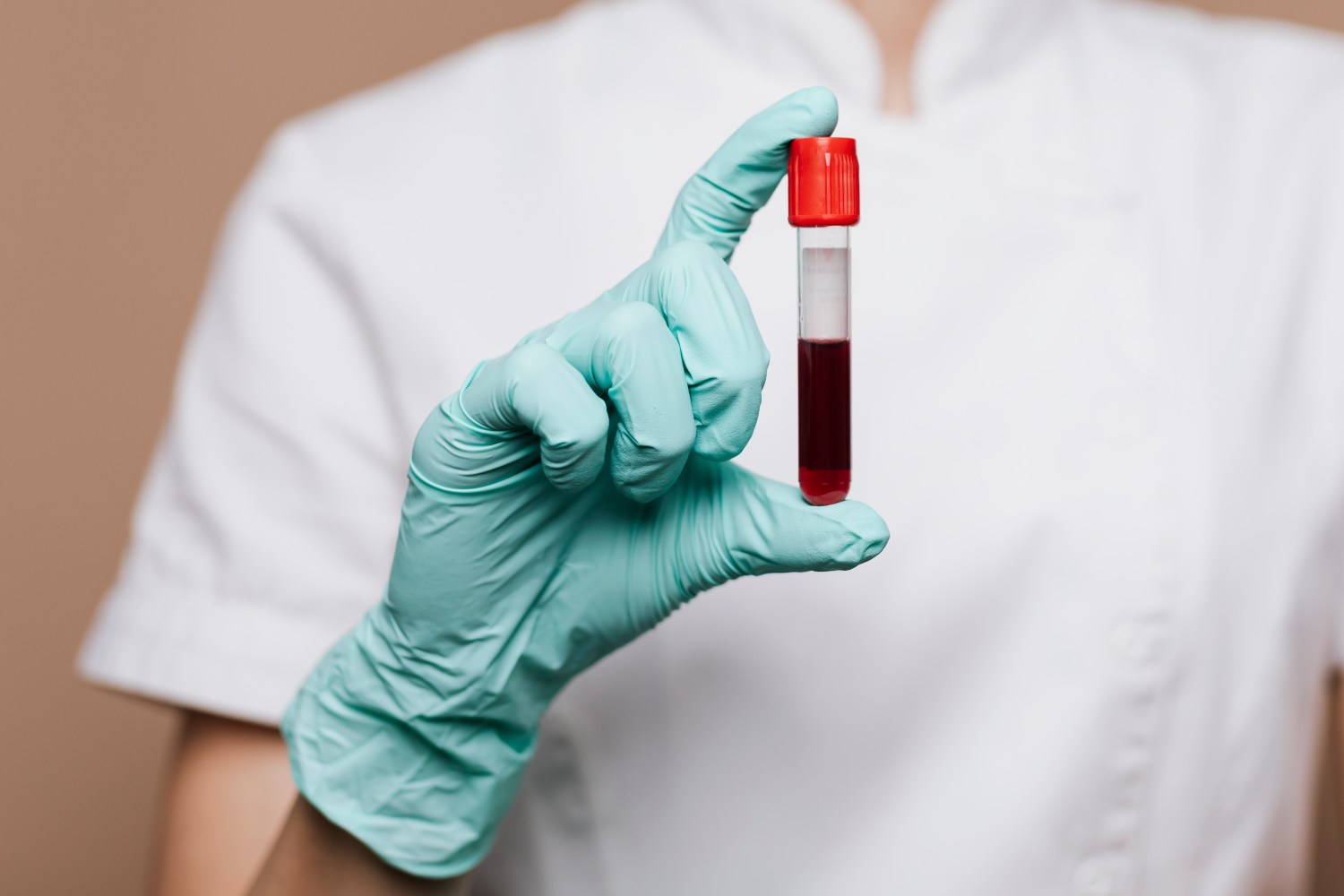 Blood tests Nicosia